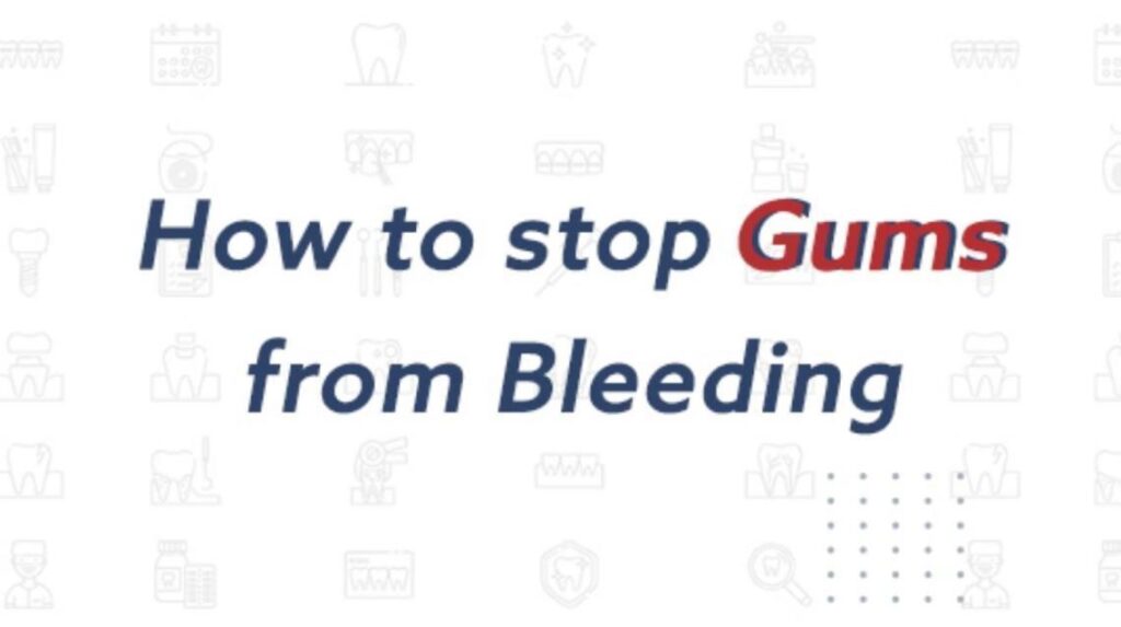 How to Stop Gum Bleeding in Case of Emergency