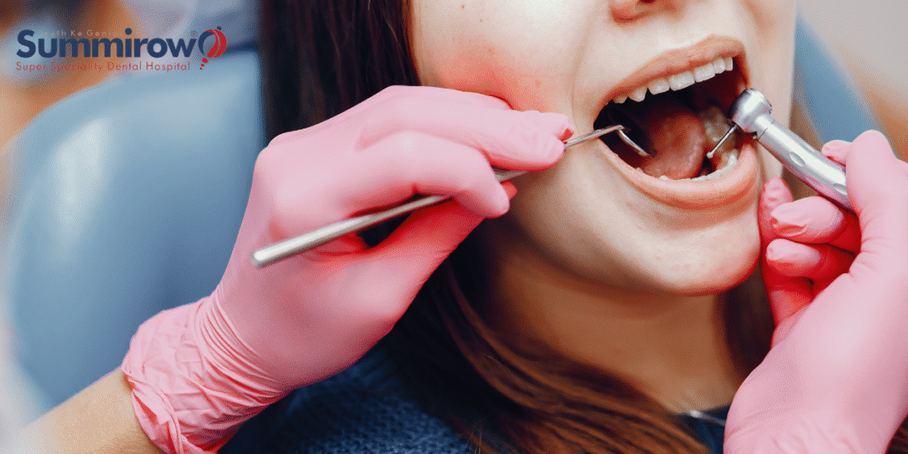 5 Steps Process For Transforming Perfect Digital Smile Makeover